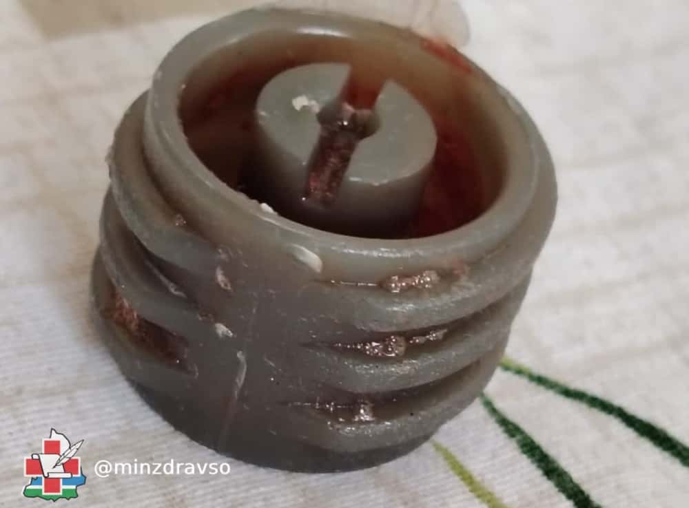 Врачи Североуральска спасли ребёнка, проглотившего шайбу 