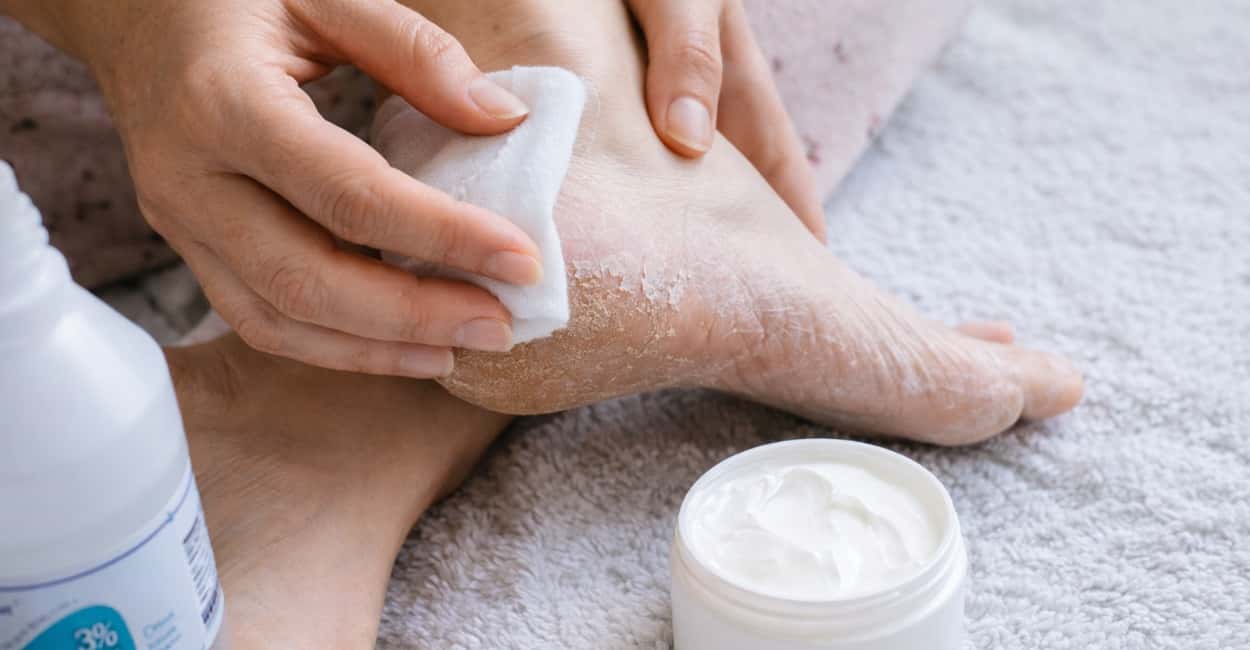 Пемзу, скраб и пилинг — в мусор: вот как легко добиться гладких и бархатистых пяточек за 20 минут
