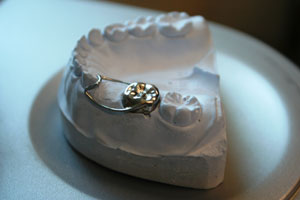 Родителям Екатеринбурга рассказали как уберечь детей от кариеса