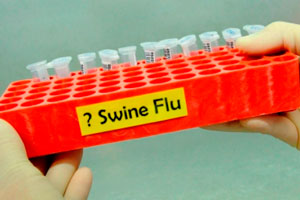 Свиной грипп в Венесуэле: погибли уже 88 человек