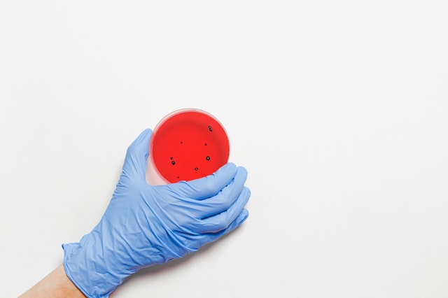 313 новых случаев COVID-19 выявлено в Свердловской области