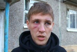 В Первоуральске жестоко избит блогер-активист. Видео