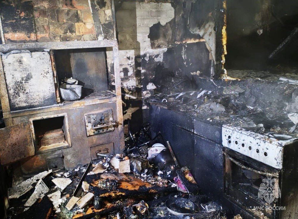 Горела одежда — школьница получила ожоги 90% тела при пожаре | В Челябинской области при пожаре сильно пострадала девочка Горела одежда — школьница получила ожоги 90% тела при пожаре | В Челябинской области при пожаре сильно пострадала девочка