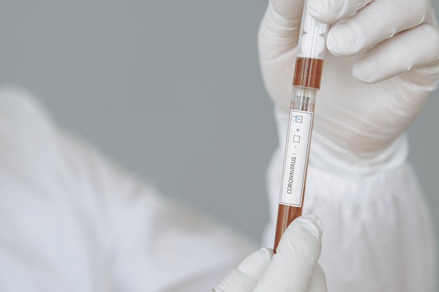 На Среднем Урале выявлено еще 264 случая COVID-19