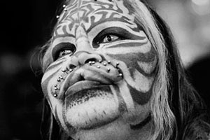 В США умер человек-кот