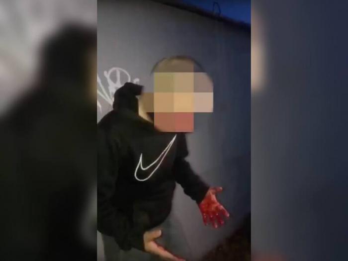 «В кровь прям» — на Урале подростки зверски избили пятиклассника  | В Свердловской области подростки зверски избили пятиклассника 
